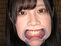 新人モデル エマちゃんの歯・口内・舌ベロを観察してみた