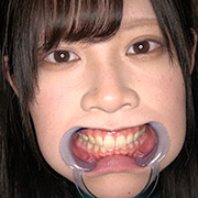 エマちゃんの歯・口内・舌ベロを観察してみた