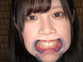 エマちゃんの歯・口内・舌ベロを観察してみた サンプル画像1