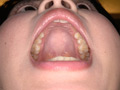 エマちゃんの歯・口内・舌ベロを観察してみた サンプル画像12