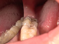 エッチなお姉さんの舌ベロ歯のどちんこをしっかり観察 画像5