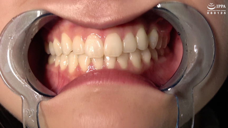 有加里ののかの歯・口内・のどちんこ観察＆顔舐めプレイ 画像4
