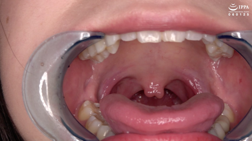 有加里ののかの歯・口内・のどちんこ観察＆顔舐めプレイ 画像6