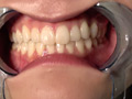 有加里ののかの歯・口内・のどちんこ観察＆顔舐めプレイ 画像4
