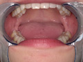 有加里ののかの歯・口内・のどちんこ観察＆顔舐めプレイ サンプル画像5