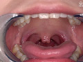 有加里ののかの歯・口内・のどちんこ観察＆顔舐めプレイ 画像6
