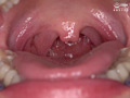 有加里ののかの歯・口内・のどちんこ観察＆顔舐めプレイ 画像7