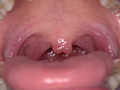 有加里ののかの歯・口内・のどちんこ観察＆顔舐めプレイ 画像8