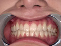 有加里ののかの歯・口内・のどちんこ観察＆顔舐めプレイ サンプル画像10