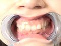 [adoa-1286] とってもフェチな歯・のどちんこ・顔舐め観察＆柔軟体操 Nanaのキャプチャ画像 6