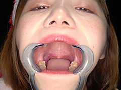 [adoa-1294] 七堂蓮未の口内・歯・のどちんこ観察からの巨大女プレイのイメージ画像