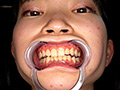 [adoa-1401] 【歯・口腔】ドM女子の口内・歯・のどちんこ観察★ 伊織ひなの