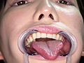 アイドルの激レアな舌、のどちんこ、歯観察プレイ