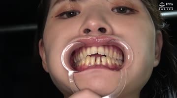 乙羽あむ出演作品: 乙羽あむチャンの超レアの歯・口内・舌ベロ観察！