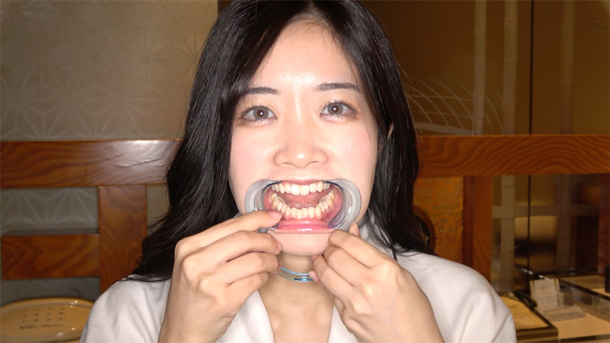 初めての口内・のどちんこ観察！ことね（5） 画像2