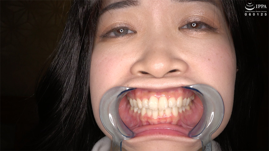 初めての口内・のどちんこ観察！ことね（5） 画像3