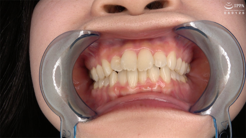 初めての口内・のどちんこ観察！ことね（5） 画像4