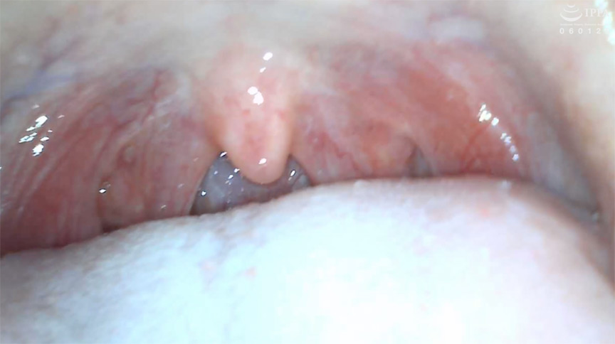 初めての口内・のどちんこ観察！ことね（5） 画像10