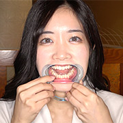 初めての口内・のどちんこ観察！ことね（5）