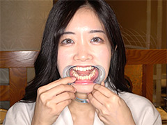 【口内】「国民的女優激似美女ことねチャンの初めての口内・のどちんこ観察！」ことね（5）