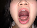 初めての口内・のどちんこ観察！ことね（5） サンプル画像7