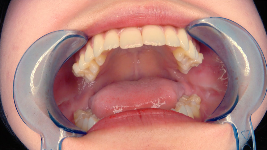 初めての口内・のどちんこ観察＆小魚舐め！加護まり 画像3