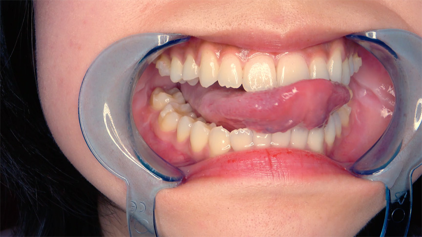 初めての口内・のどちんこ観察＆小魚舐め！加護まり 画像4