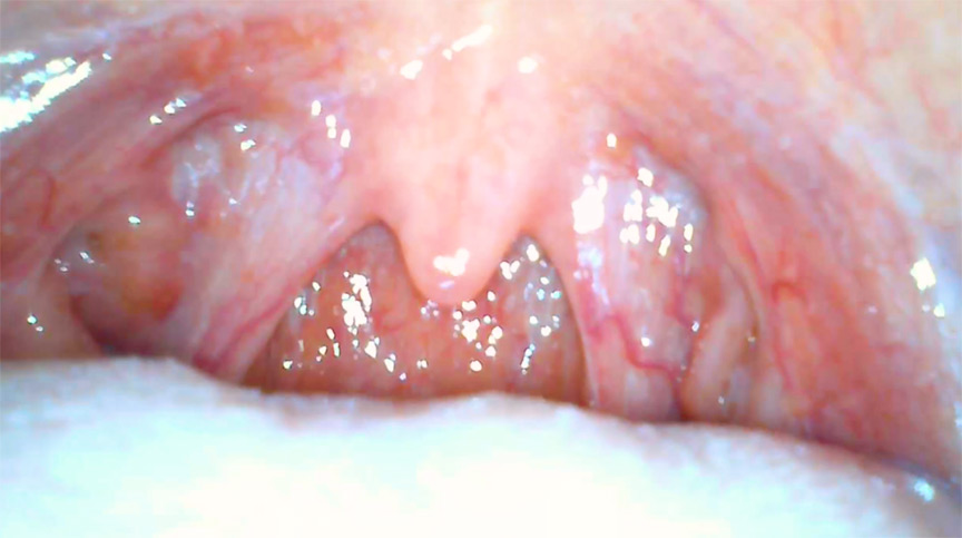 初めての口内・のどちんこ観察＆小魚舐め！加護まり 画像10