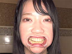 清楚美女・葉月英里チャンの口内観察をお届け致します！開口器を使い歯をしっかりと見…