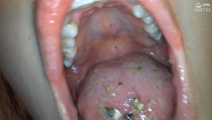 激レアの口内観察・のどちんこ観察・咀嚼！ 琥珀やや2 画像4