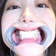 激レアの口内観察・のどちんこ観察・咀嚼！ 琥珀やや2