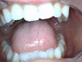 Capture-Image