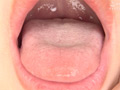 「大人気美女ゆきねさんの激レア口内・銀歯観察！」 サンプル画像5