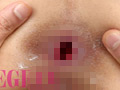 素人アナル 初撮りドキュメント 画像5