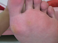 [脚・足裏・つま先]フェチの世界 足舐め撮り 22人の悶える足のサンプル画像39