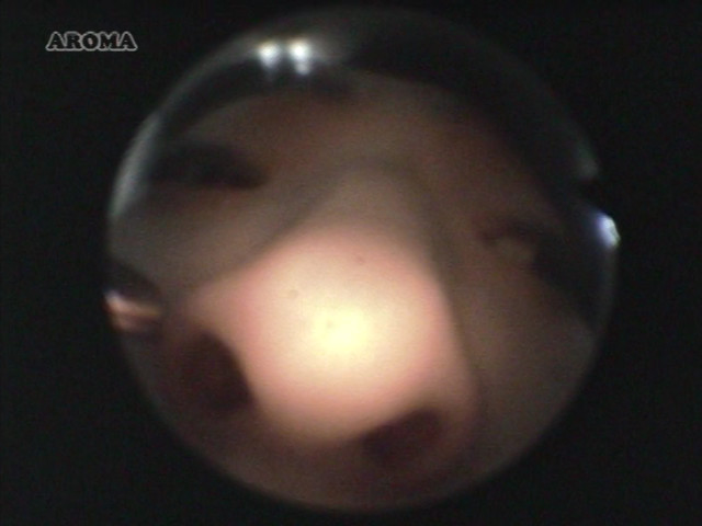【aroma-0712】耳鼻科の女の見所画像13