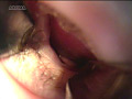 [aroma-0712] 耳鼻科の女のキャプチャ画像 4