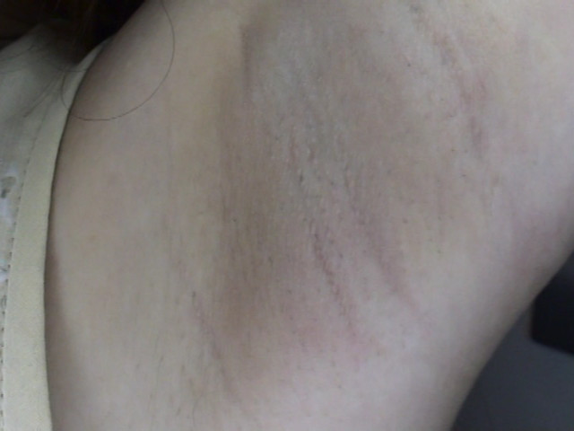 100人のわき 第1集