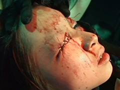 【エロ動画】流血瞼縫合のSM凌辱エロ画像