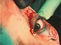 [etekiya-0008] 流血瞼縫合のキャプチャ画像 5