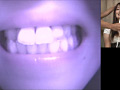 歯01のサンプル画像2