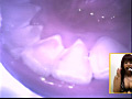 歯02のサンプル画像3