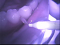 歯02のサンプル画像8