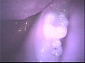 歯03のサンプル画像4