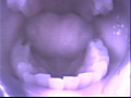 歯03 サンプル画像9