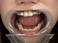 歯05のサンプル画像8