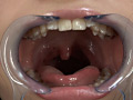 歯05のサンプル画像9