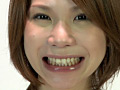 歯06のサンプル画像1