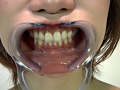 歯06のサンプル画像3