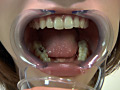 歯06のサンプル画像4